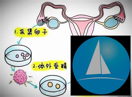 试管婴儿带来新生--试管妈妈的自述