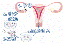 通过试管婴儿可以生育双胞胎吗?